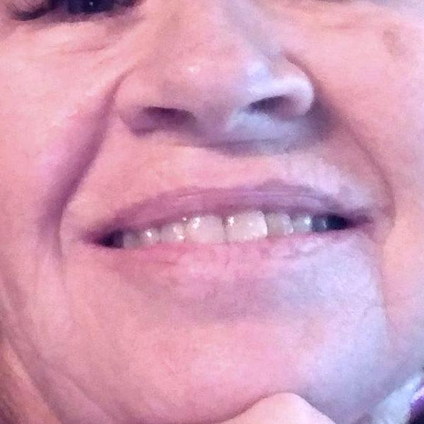 TERESA